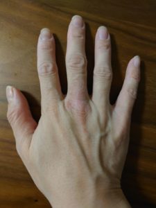 ＥＯＲＡ(エオラ)ハンドパック　使用前の手